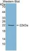 TIMP Metallopeptidase Inhibitor 1 antibody, LS-C690963, Lifespan Biosciences, Western Blot image 