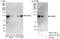 Zinc finger protein 148 antibody, A303-116A, Bethyl Labs, Western Blot image 