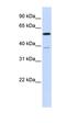 Protein Phosphatase 2 Regulatory Subunit B'Alpha antibody, orb330528, Biorbyt, Western Blot image 