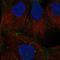 Desmoglein 2 antibody, HPA004896, Atlas Antibodies, Immunocytochemistry image 
