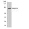 Protein Kinase C Gamma antibody, LS-C200528, Lifespan Biosciences, Western Blot image 