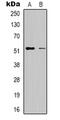 Radical S-Adenosyl Methionine Domain Containing 1 antibody, abx133527, Abbexa, Western Blot image 