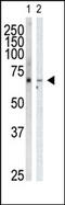 G Protein-Coupled Receptor Kinase 6 antibody, AP13531PU-N, Origene, Western Blot image 