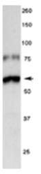 Tyrosine Hydroxylase antibody, AP31824PU-N, Origene, Western Blot image 