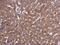 P21 (RAC1) Activated Kinase 4 antibody, PA5-78568, Invitrogen Antibodies, Immunohistochemistry frozen image 