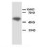 Apoptosis Inhibitor 5 antibody, GTX38554, GeneTex, Western Blot image 