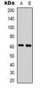 Zinc Finger Protein 397 antibody, LS-C368831, Lifespan Biosciences, Western Blot image 