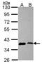 Aminoacyl TRNA Synthetase Complex Interacting Multifunctional Protein 1 antibody, GTX115209, GeneTex, Western Blot image 