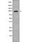 Mitogen-Activated Protein Kinase Kinase Kinase 20 antibody, PA5-64615, Invitrogen Antibodies, Western Blot image 