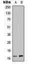 Angiogenin antibody, GTX56205, GeneTex, Western Blot image 