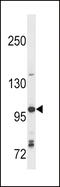 Toll Like Receptor 7 antibody, 58-165, ProSci, Western Blot image 