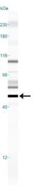 Erythropoietin Receptor antibody, NBP1-19388, Novus Biologicals, Western Blot image 