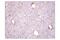 Dihydropyrimidinase Like 2 antibody, 35672S, Cell Signaling Technology, Immunohistochemistry paraffin image 