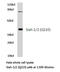 Siah E3 Ubiquitin Protein Ligase 1 antibody, LS-C176938, Lifespan Biosciences, Western Blot image 