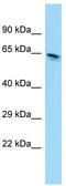 Eukaryotic Elongation Factor, Selenocysteine-TRNA Specific antibody, TA338006, Origene, Western Blot image 