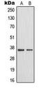 Microtubule Associated Serine/Threonine Kinase Family Member 4 antibody, MBS822071, MyBioSource, Western Blot image 