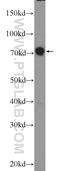 Junctophilin 1 antibody, 25979-1-AP, Proteintech Group, Western Blot image 