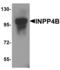 Inositol Polyphosphate-4-Phosphatase Type II B antibody, LS-B13101, Lifespan Biosciences, Western Blot image 