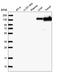 Collagen Type VI Alpha 2 Chain antibody, HPA038799, Atlas Antibodies, Western Blot image 