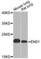 Endothelin 1 antibody, A0686, ABclonal Technology, Western Blot image 