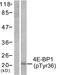 Eukaryotic Translation Initiation Factor 4E Binding Protein 1 antibody, LS-C117283, Lifespan Biosciences, Western Blot image 