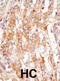 Mitogen-Activated Protein Kinase Kinase Kinase 6 antibody, abx033759, Abbexa, Immunohistochemistry frozen image 