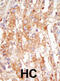 MAP3K6 antibody, abx033759, Abbexa, Immunohistochemistry frozen image 