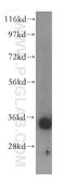 Aminoacylase 3 antibody, 16786-1-AP, Proteintech Group, Western Blot image 