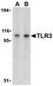 Toll Like Receptor 3 antibody, ADI-905-726-100, Enzo Life Sciences, Western Blot image 
