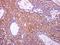 Aconitase 1 antibody, GTX128976, GeneTex, Immunohistochemistry paraffin image 