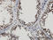 PDZ Binding Kinase antibody, LS-C133785, Lifespan Biosciences, Immunohistochemistry frozen image 