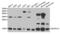 NADH:Ubiquinone Oxidoreductase Subunit A13 antibody, abx004146, Abbexa, Western Blot image 