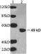 Beta-1,3-Galactosyltransferase 2 antibody, LS-C51647, Lifespan Biosciences, Western Blot image 