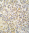Aldehyde Dehydrogenase 1 Family Member A3 antibody, 63-239, ProSci, Immunohistochemistry paraffin image 