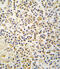 Aldehyde dehydrogenase family 1 member A3 antibody, 63-239, ProSci, Immunohistochemistry paraffin image 