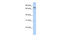 Tripartite Motif Containing 29 antibody, 25-463, ProSci, Enzyme Linked Immunosorbent Assay image 