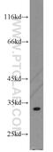 Thiamine Triphosphatase antibody, 15486-1-AP, Proteintech Group, Western Blot image 