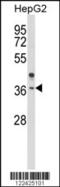 Olfactory Receptor Family 2 Subfamily H Member 2 antibody, 63-750, ProSci, Western Blot image 