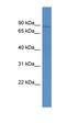 ATP Binding Cassette Subfamily B Member 10 antibody, orb330332, Biorbyt, Western Blot image 