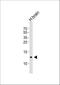 Hemoglobin Subunit Gamma 2 antibody, A01990, Boster Biological Technology, Western Blot image 