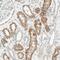 Cadherin 6 antibody, NBP1-87588, Novus Biologicals, Immunohistochemistry paraffin image 