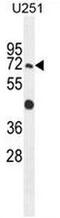 Glycosylphosphatidylinositol Anchor Attachment 1 antibody, AP51898PU-N, Origene, Western Blot image 