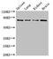 Protein Arginine Methyltransferase 7 antibody, CSB-PA885738LA01HU, Cusabio, Western Blot image 