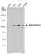 Actinin Alpha 4 antibody, NBP2-15358, Novus Biologicals, Western Blot image 