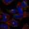 Component Of Oligomeric Golgi Complex 2 antibody, NBP2-57681, Novus Biologicals, Immunocytochemistry image 