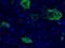 Actin Alpha 2, Smooth Muscle antibody, MA5-11547, Invitrogen Antibodies, Immunofluorescence image 