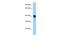 Phosphoribosyl Pyrophosphate Synthetase Associated Protein 1 antibody, PA5-70215, Invitrogen Antibodies, Western Blot image 