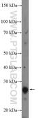 RP9 Pre-MRNA Splicing Factor antibody, 16832-1-AP, Proteintech Group, Western Blot image 
