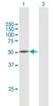 Protein Phosphatase 2 Regulatory Subunit B''Gamma antibody, H00055012-B01P, Novus Biologicals, Western Blot image 