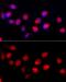Adenosine Deaminase RNA Specific antibody, GTX64415, GeneTex, Immunocytochemistry image 
